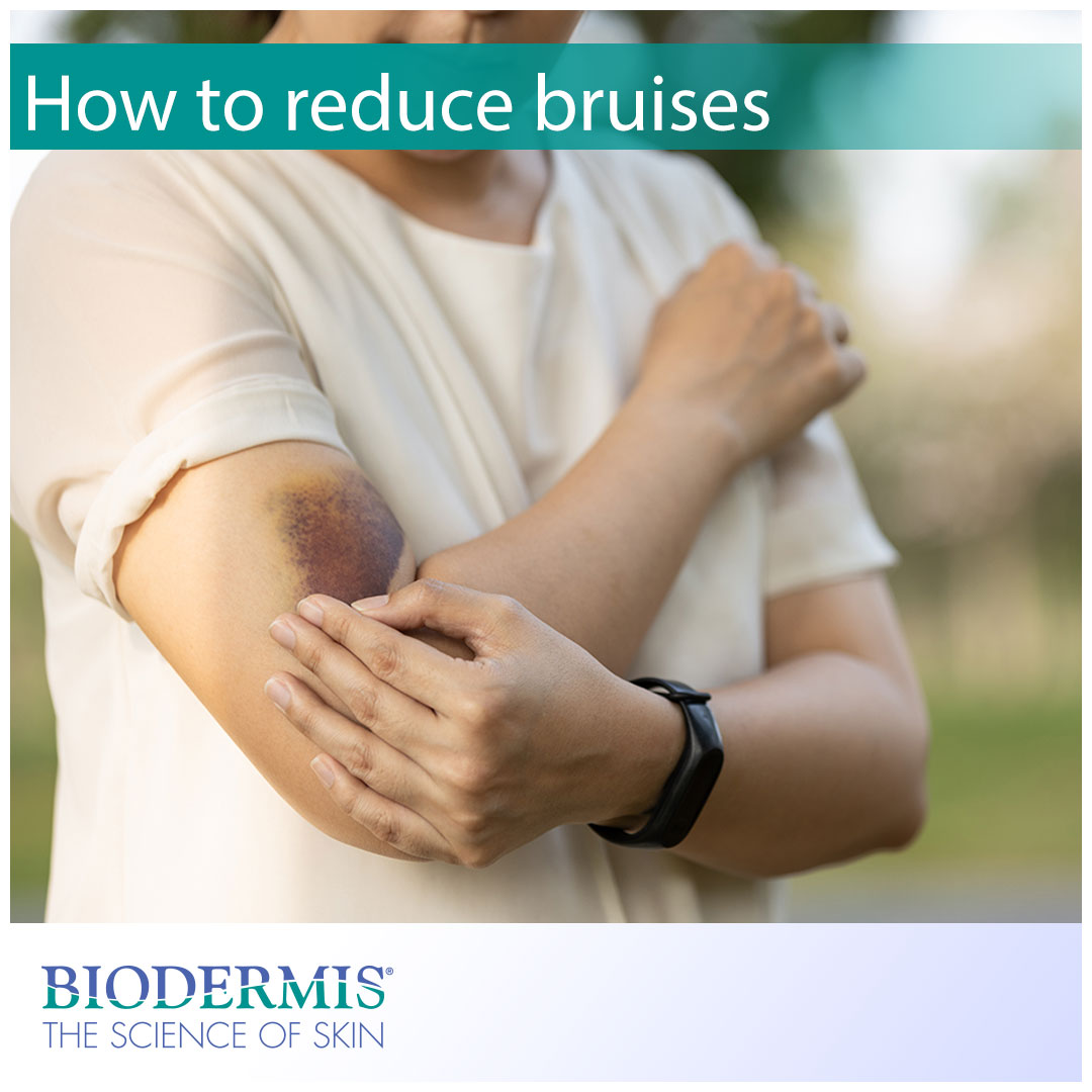 Top 10 Strategies to Reduce Bruising After Breast Uplift Surgery