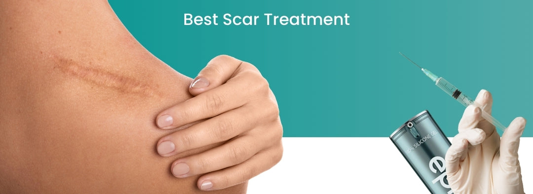 Best Scar Treatment