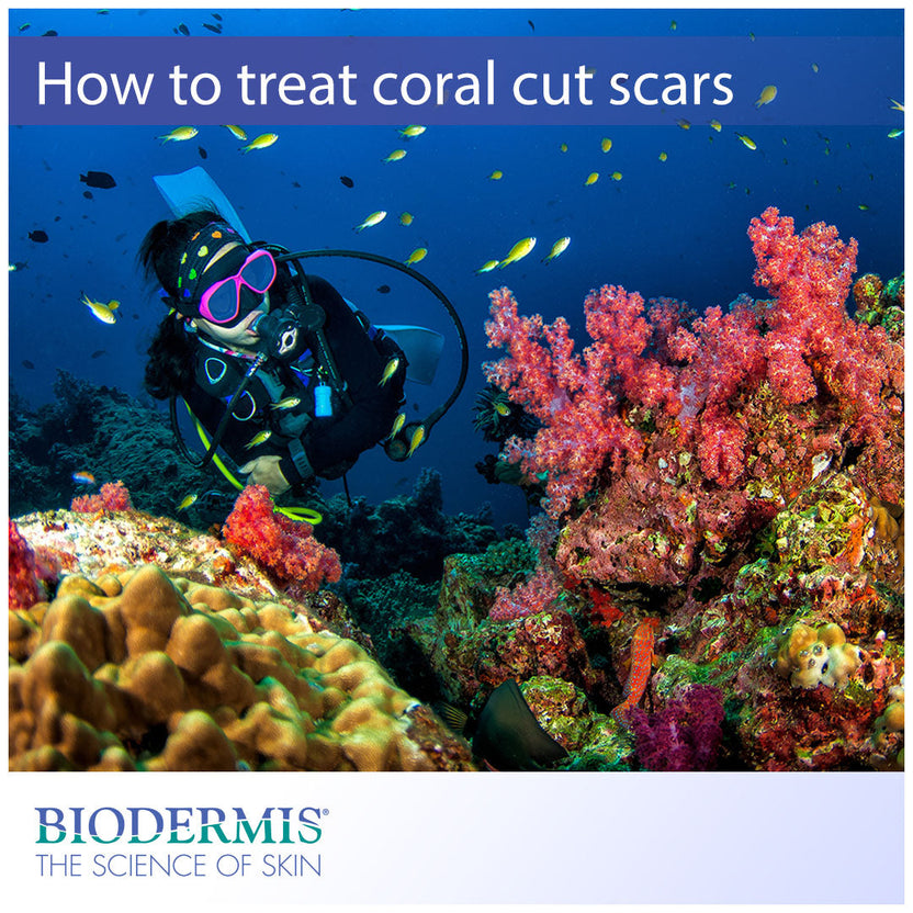 How to Treat Coral Cut Scars | Biodermis.com